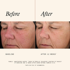 SkinMedica ingredient label focused on formulation transparency and confidence