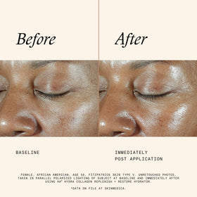 SkinMedica label highlighting VITISENSCE and vegan collagen ingredients