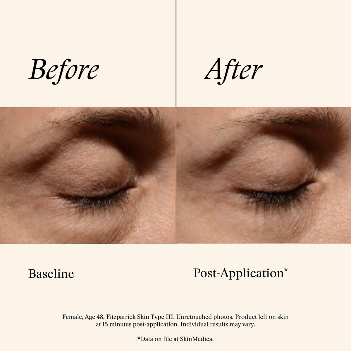 SkinMedica ingredient callout showing hyaluronic acid blend for smoother skin