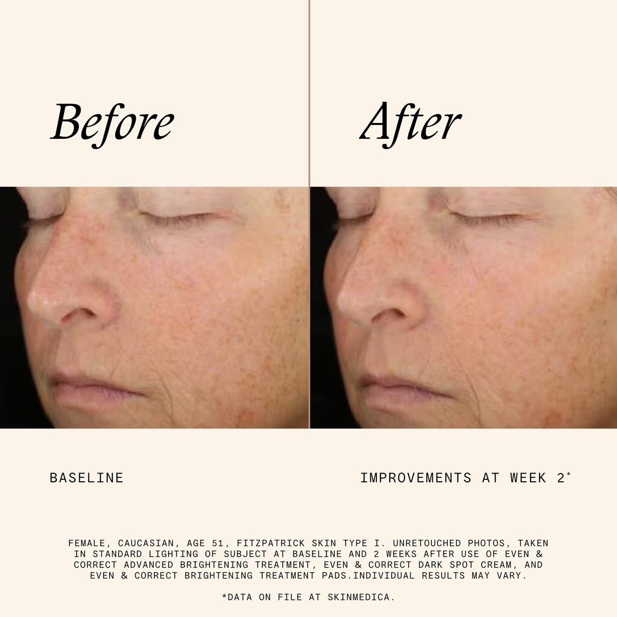 Hand applying SkinMedica pad to skin demonstrating easy application