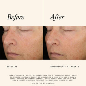 Hand applying SkinMedica pad to skin demonstrating easy application