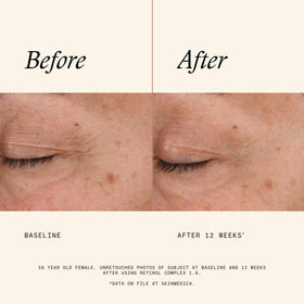SkinMedica ingredient label detail highlighting key retinol and PhytoShield benefits