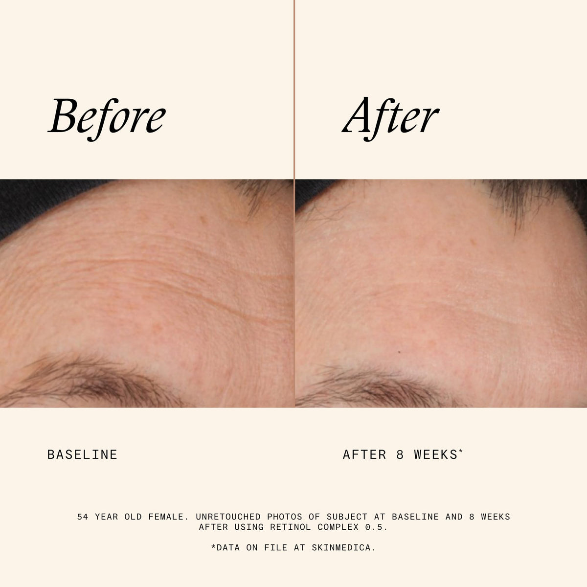 SkinMedica ingredient label close-up showing retinol, niacinamide, peptides for multi-target benefits