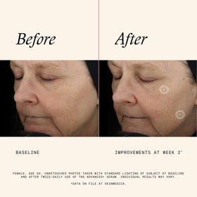 SkinMedica pump dispense action showing precise, mess-free application