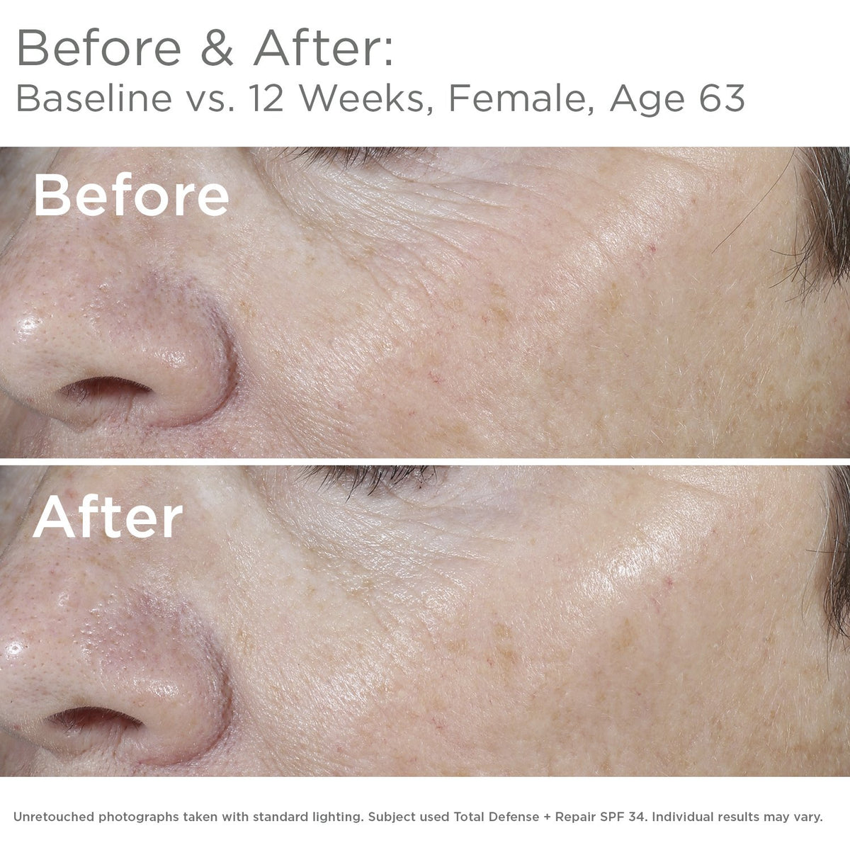 SkinMedica close-up texture of sunscreen showing lightweight finish