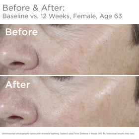 SkinMedica close-up texture of sunscreen showing lightweight finish
