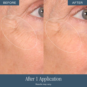 SKINN lifestyle shot prepping face for makeup, conveying improved canvas for cosmetics