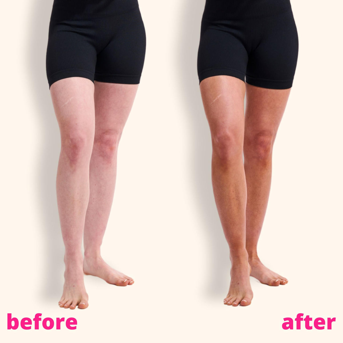 Skinny Tan before and after forearm showing natural medium bronze