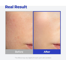 SKINSINS applied under makeup illustrating smooth layered finish