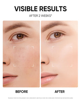 SKINTIFIC ingredient label close-up featuring TXA, niacinamide, and ceramides benefits
