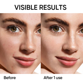 SKINTIFIC ingredient label detail showing actives for brightening benefits