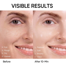 SKINTIFIC mask on model demonstrating comfortable fit and 10-minute convenience