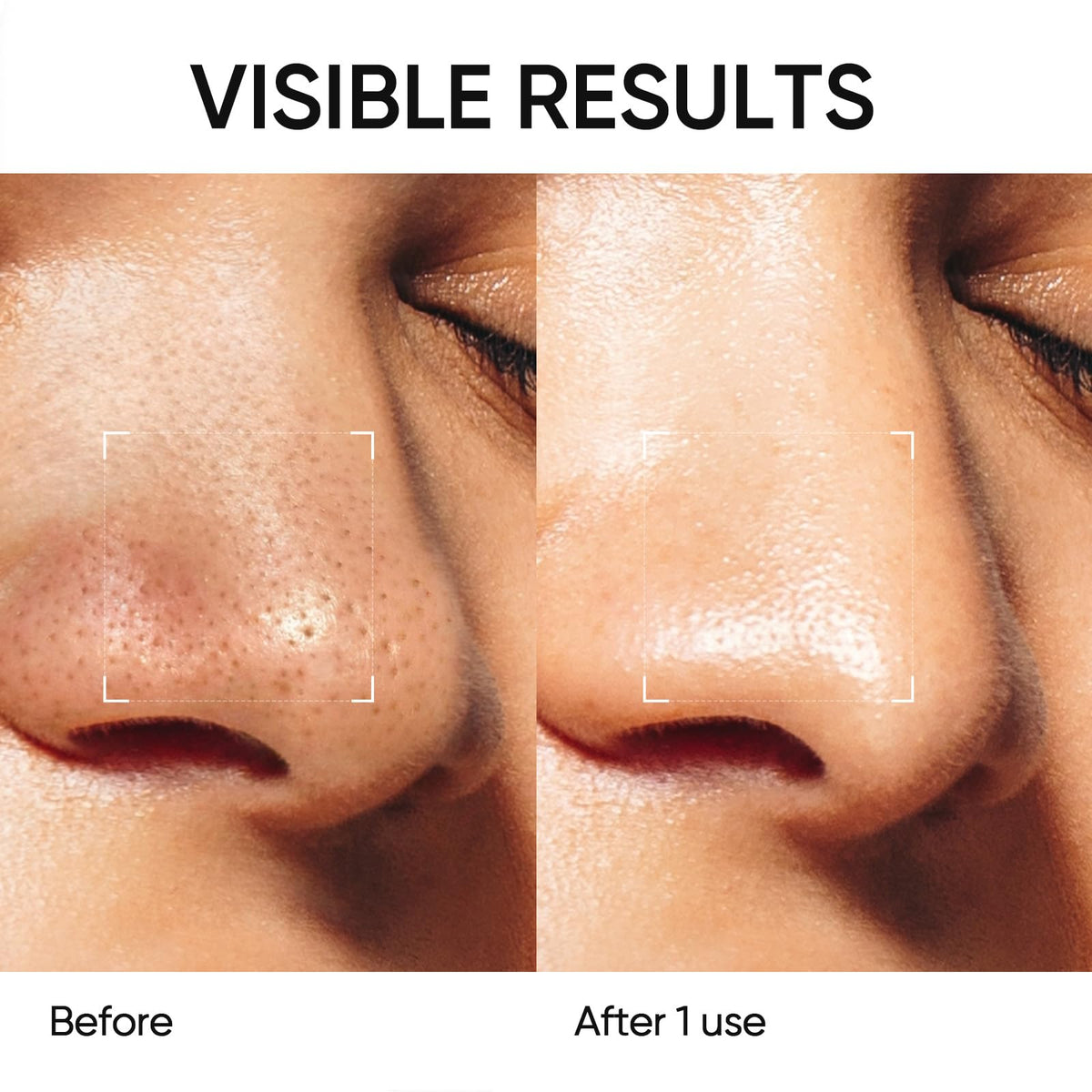 SKINTIFIC twist-up mechanism detail highlighting hygienic, no-mess dispensing benefit