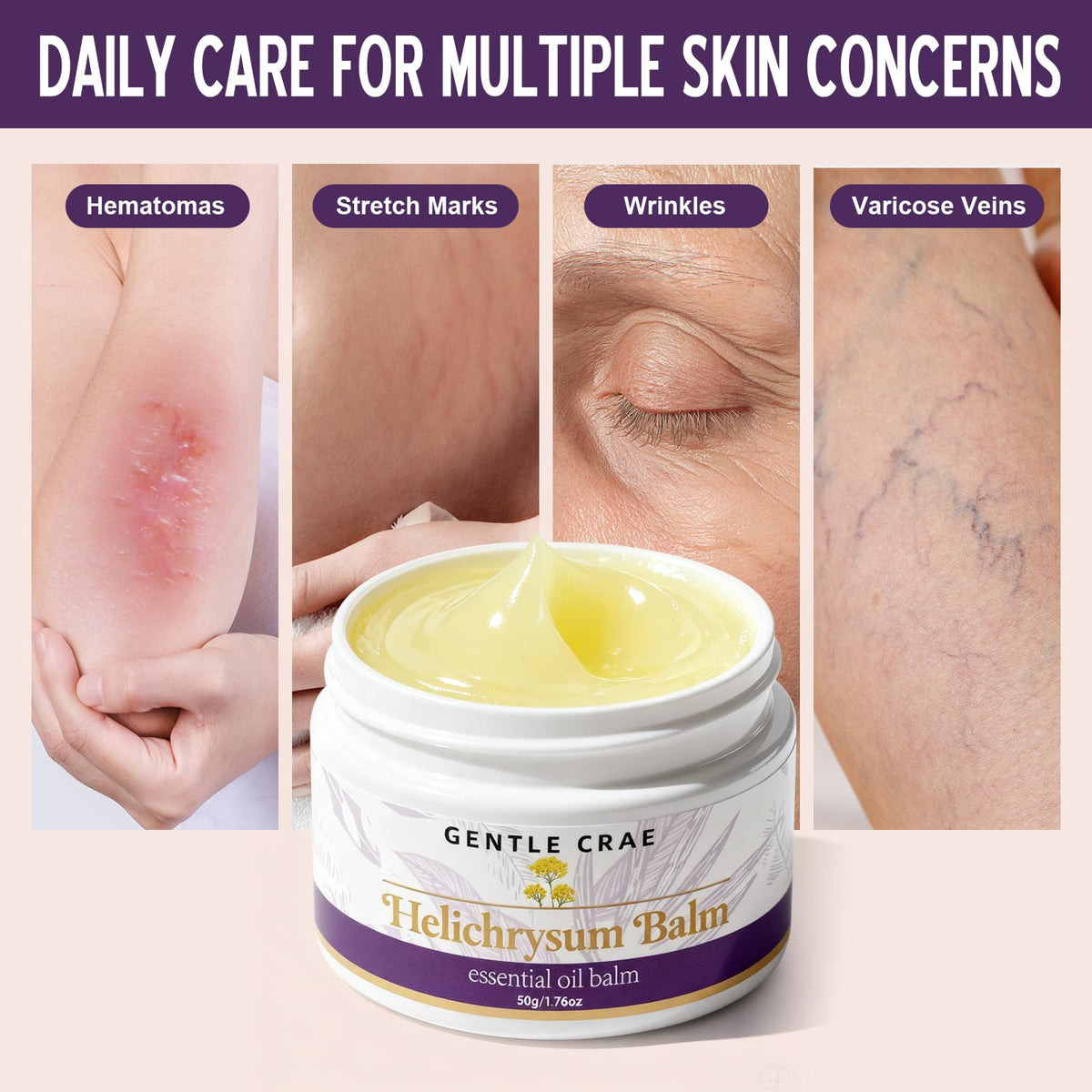 SKSOYT fingertip applying balm to lips for protective, lasting moisture