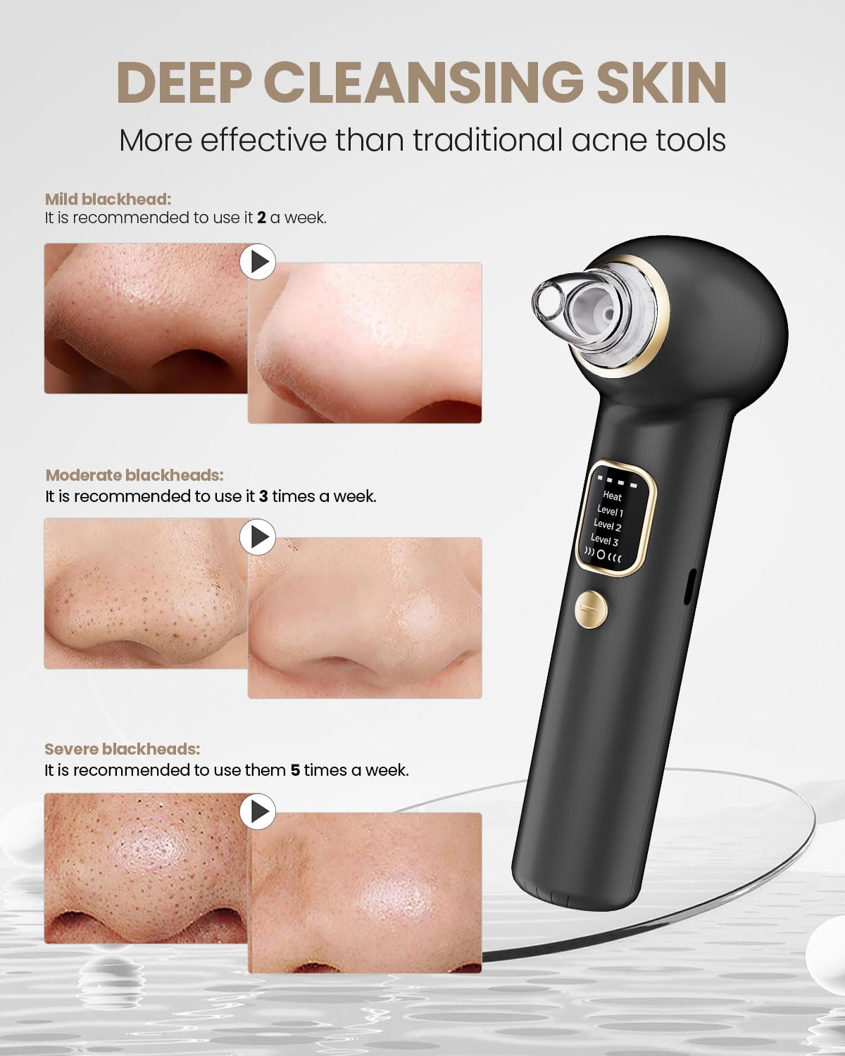 SKUGF nose-fit probe detail for improved contact and precise removal