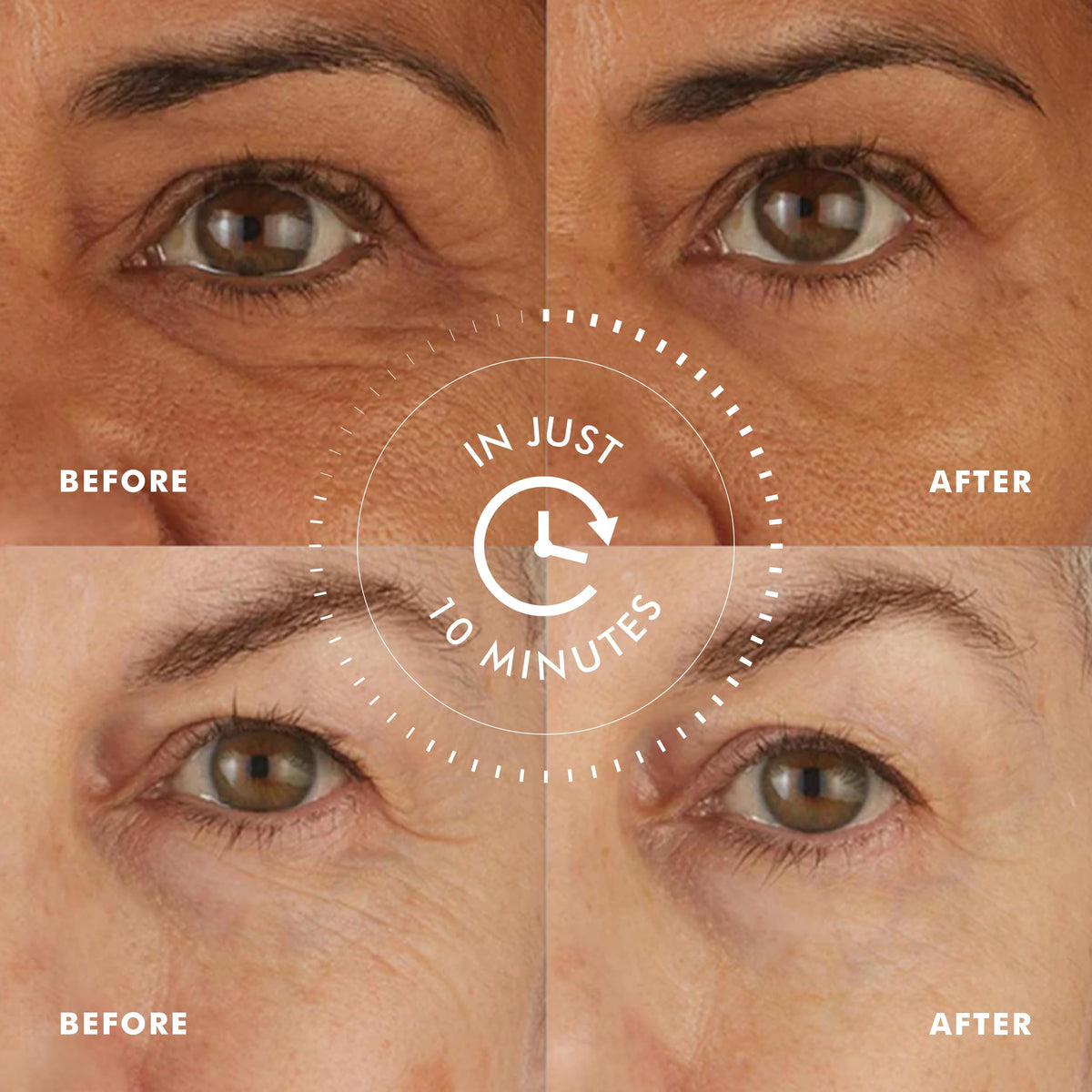 skyn ICELAND patch applied under eye demonstrating instant refresh