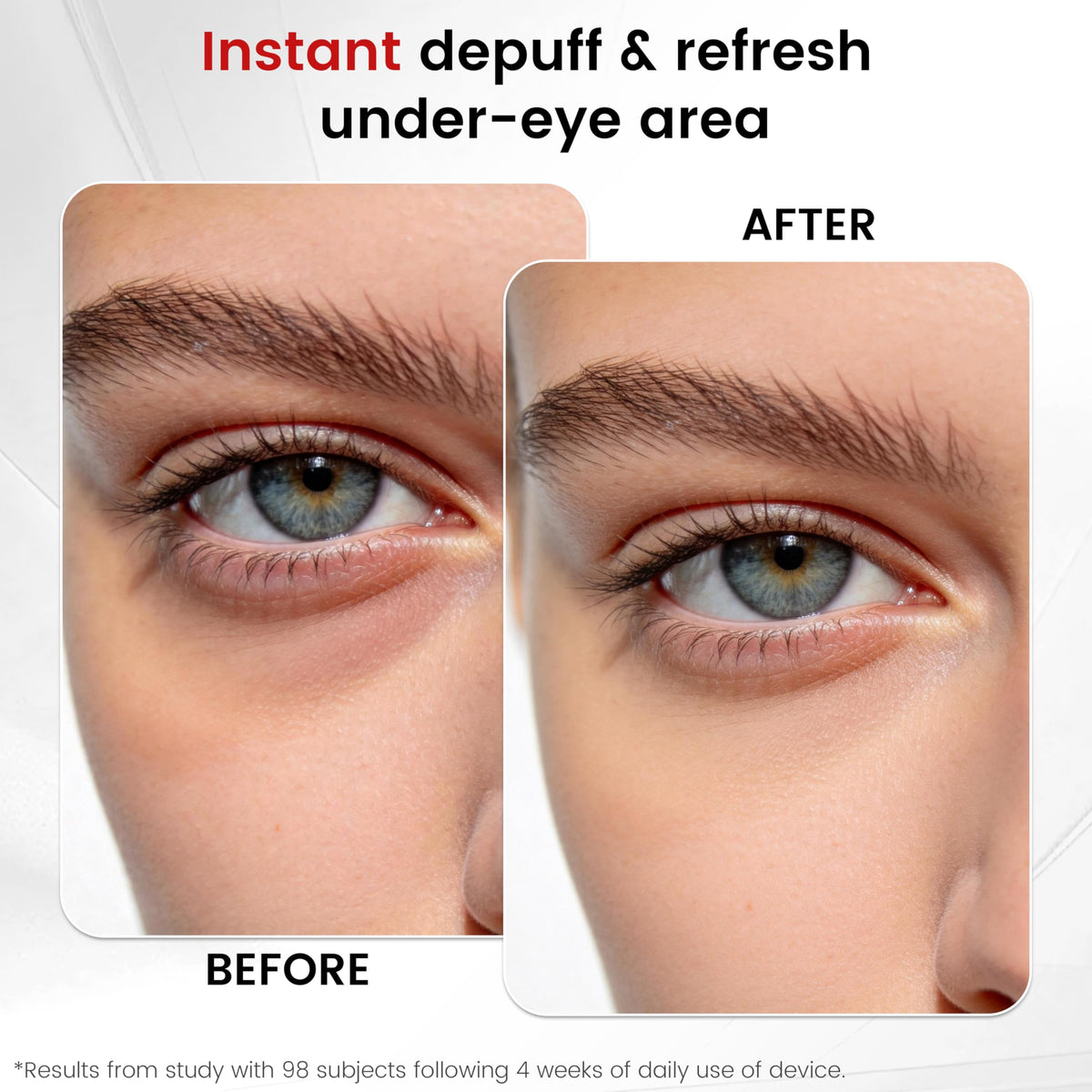 SLLIOS wand used with serum to enhance absorption and leave skin radiant