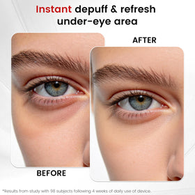SLLIOS wand used with serum to enhance absorption and leave skin radiant