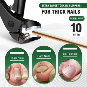 SMZHealing 45-degree slanted jaw closeup showing precise tips for ingrown nail edges
