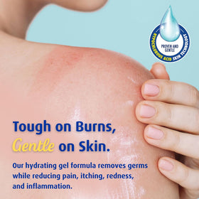 Solarcaine being applied on forearm to soothe sun irritation
