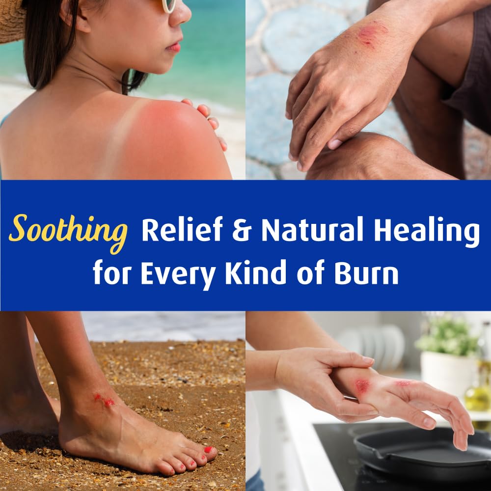 Solarcaine applied to face demonstrating gentle, sting-free relief