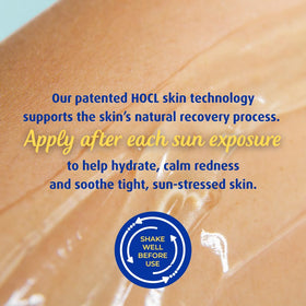 Solarcaine pump dispensing gel for mess-free application benefit