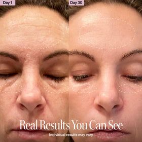 Solawave wand treating under-eye area to reduce puffiness and boost absorption