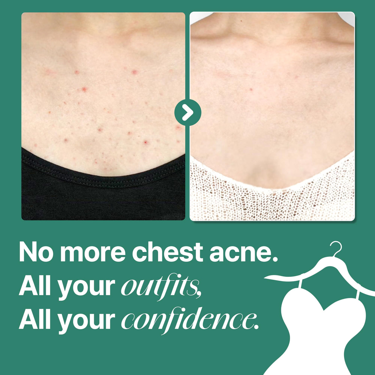 SOME BY MI body cleanser in use on back in shower showing effective cleaning