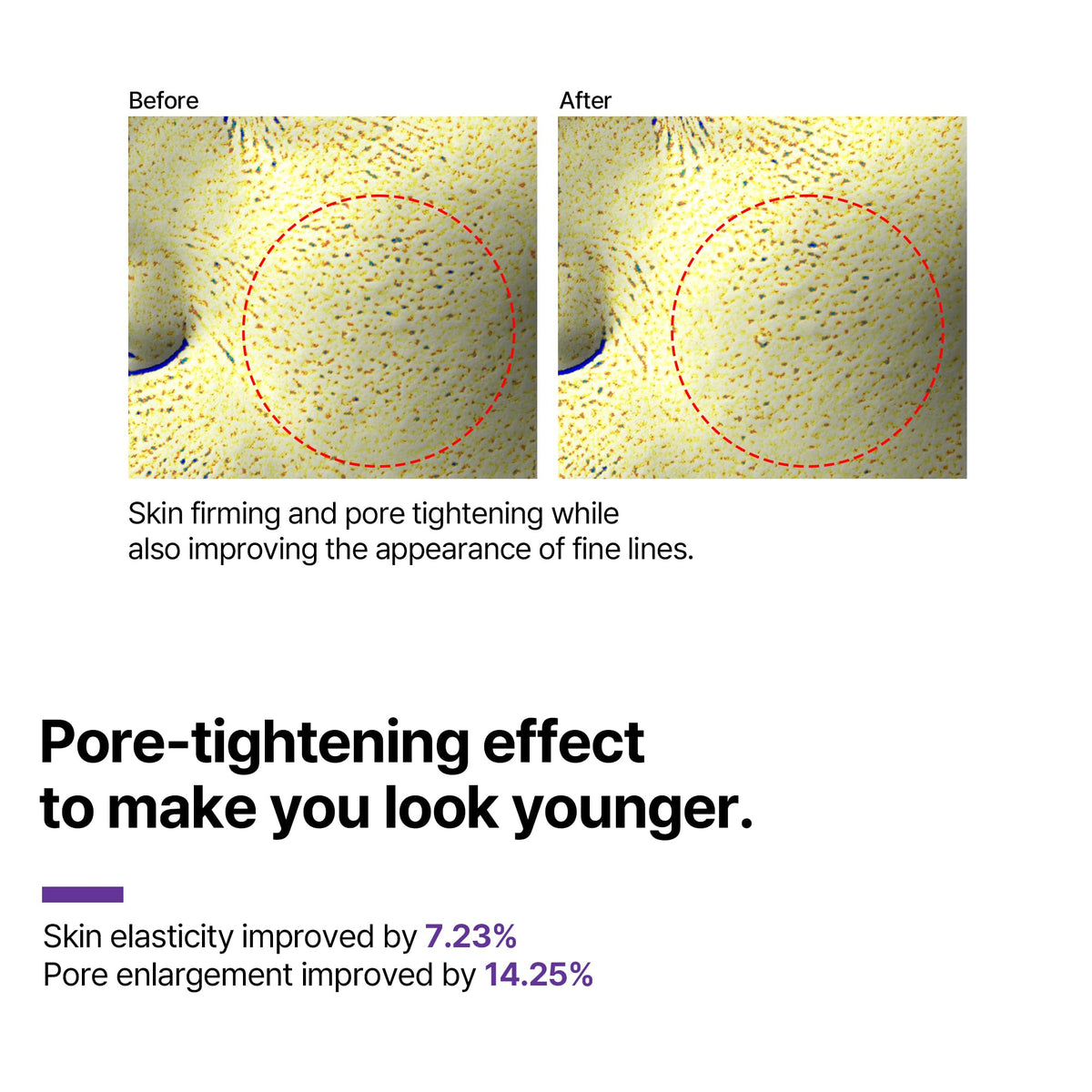 SOME BY MI label close-up displaying directions and hypoallergenic formulation benefits