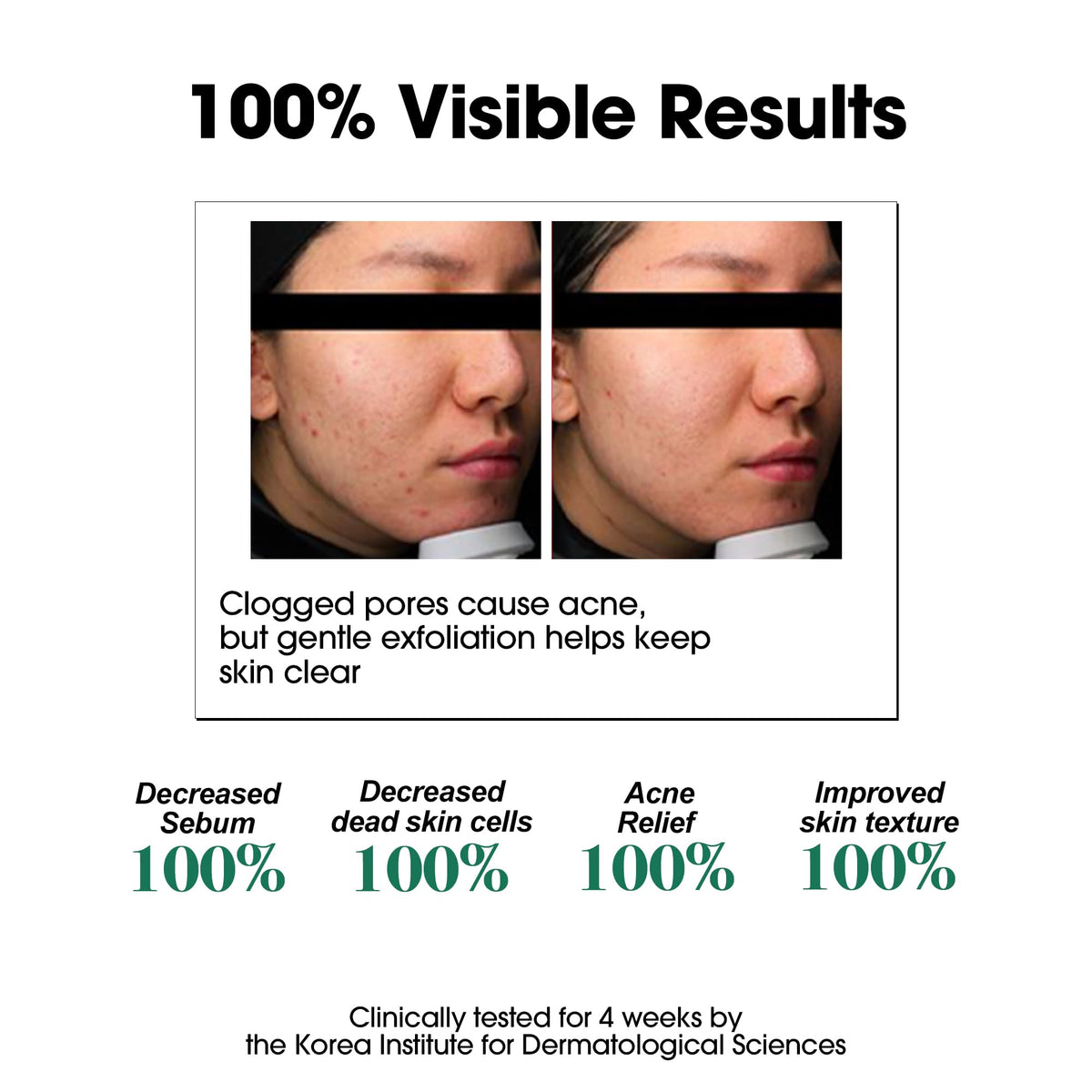 SOME BY MI toner on cotton pad demonstrating easy application benefit