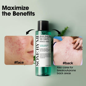 SOME BY MI bottle with plant elements conveying gentle exfoliation benefit