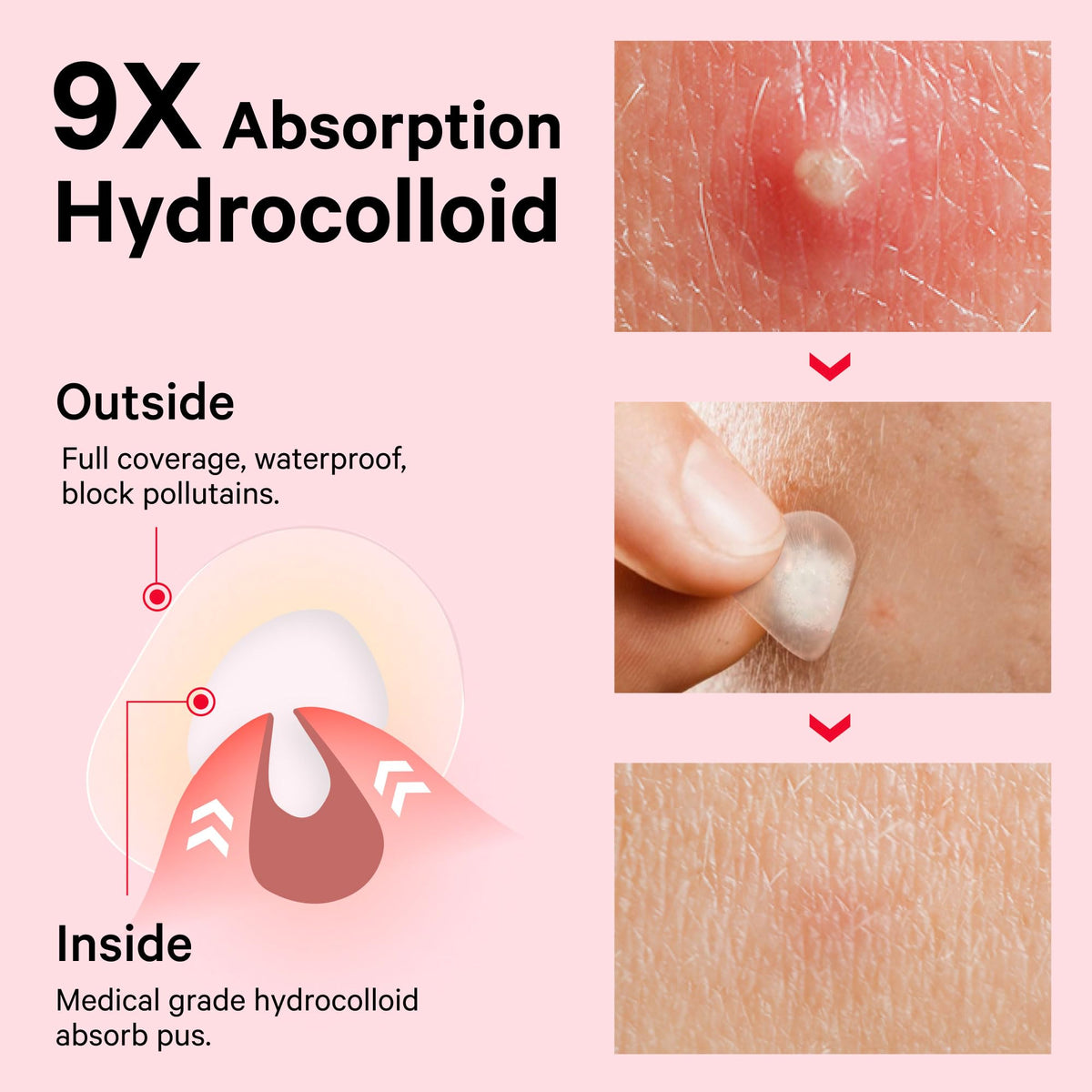Sosky patch applied on cheek demonstrating protective absorption benefit