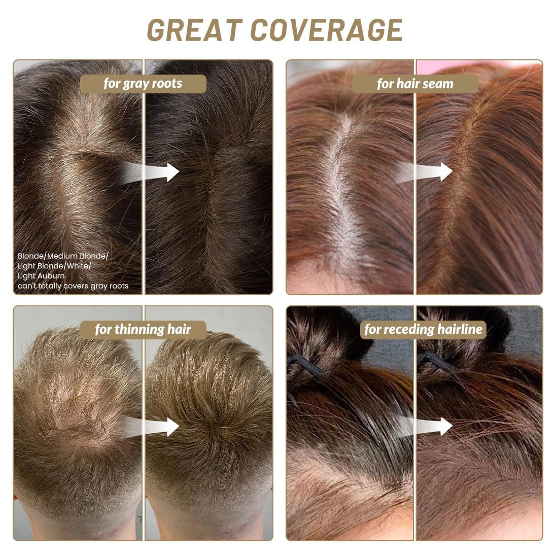 SOVONCARE sponge applicator detail demonstrating precise targeted application