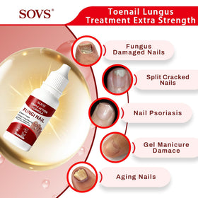 SOVS being applied to a toenail showing easy daily use and convenience