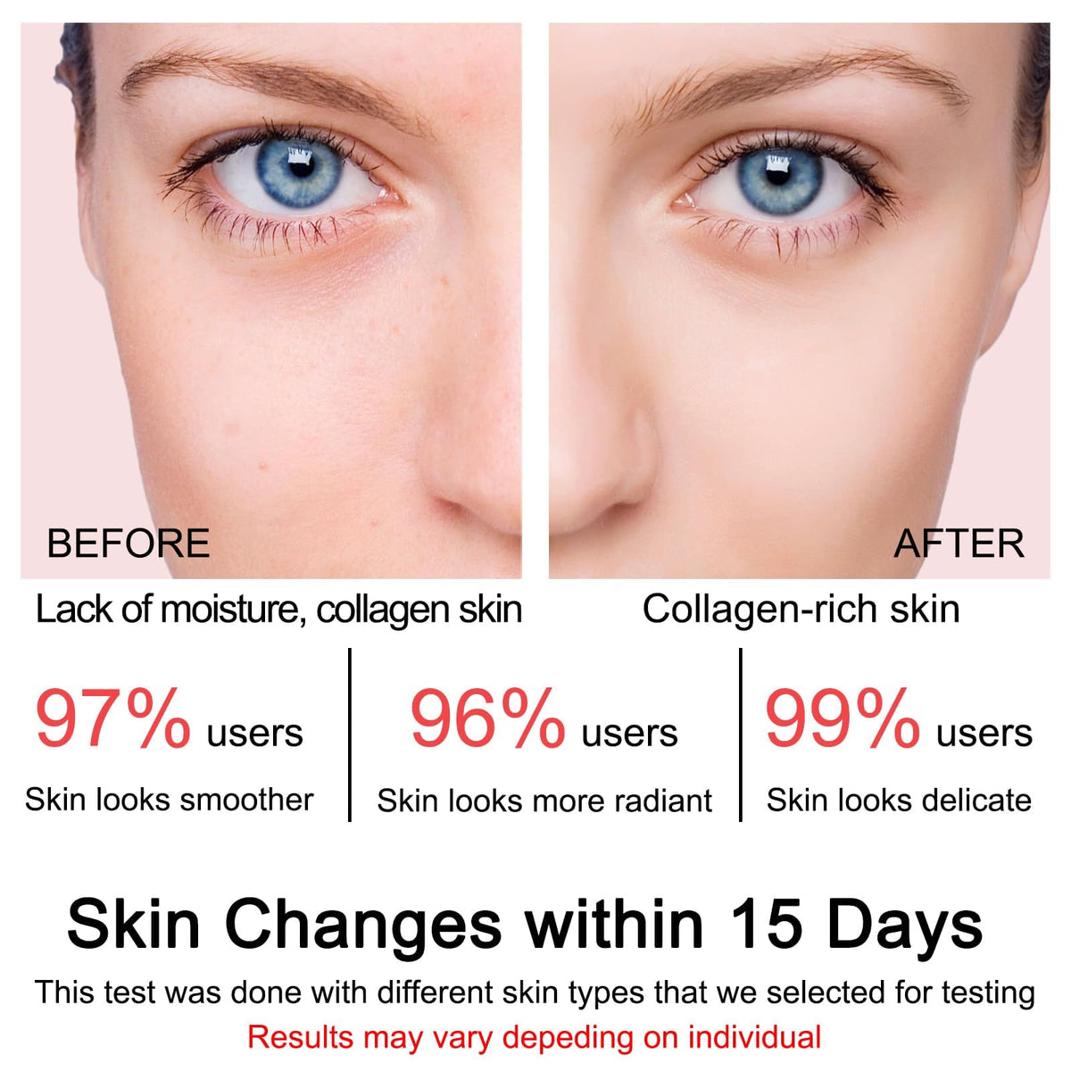 SOYUB cream being smoothed on skin to boost elasticity