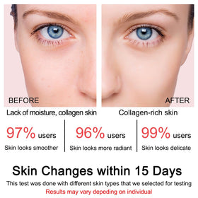 SOYUB cream being smoothed on skin to boost elasticity