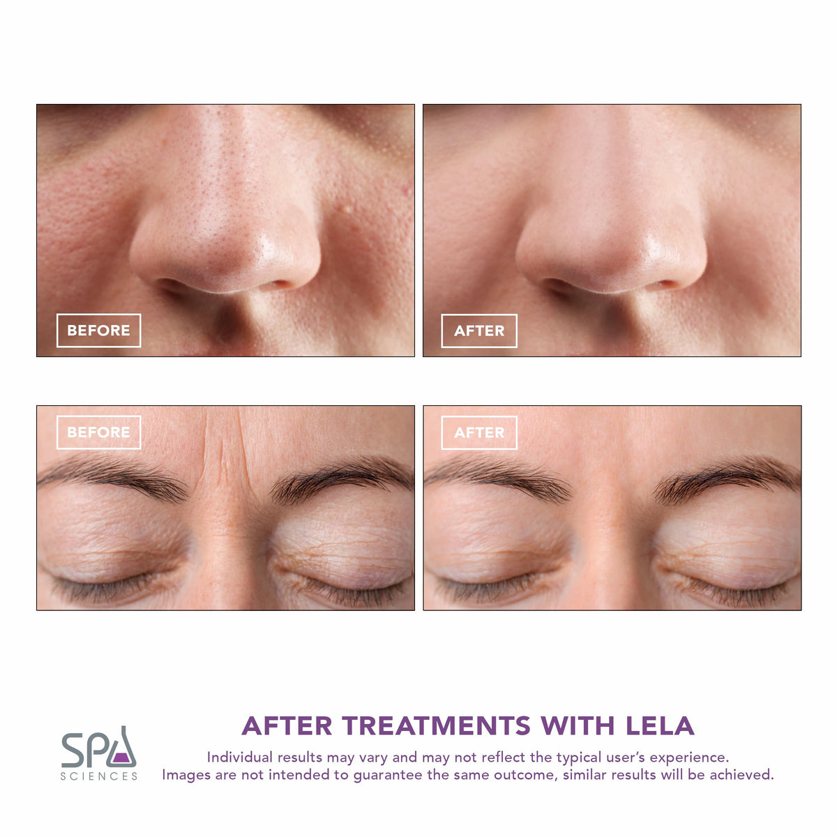SPA SCIENCES LELA gliding over serum to boost absorption and enhance product performance
