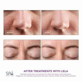 SPA SCIENCES LELA gliding over serum to boost absorption and enhance product performance