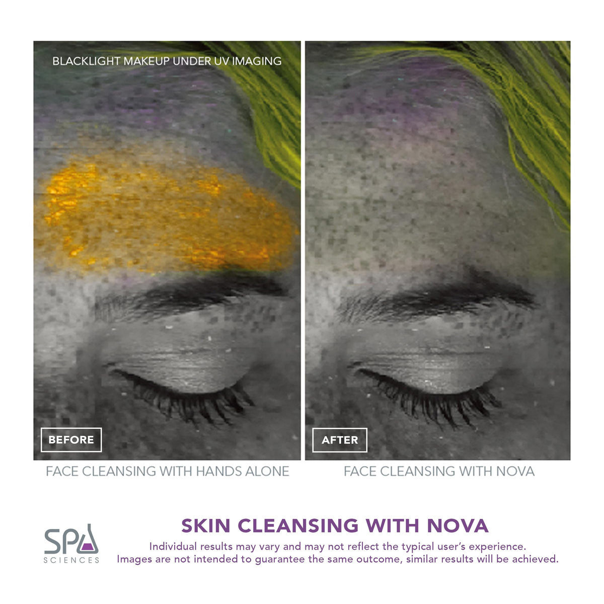 Spa Sciences NOVA applying serum with infusion head to boost skincare product penetration