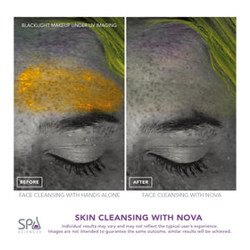 Spa Sciences NOVA applying serum with infusion head to boost skincare product penetration