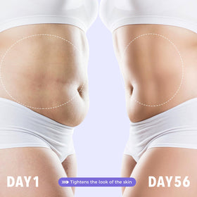 sperandi applying whip to belly demonstrating targeted firming and smoothing