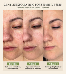 Srripo scrub in hand applied to skin for visible polishing benefit