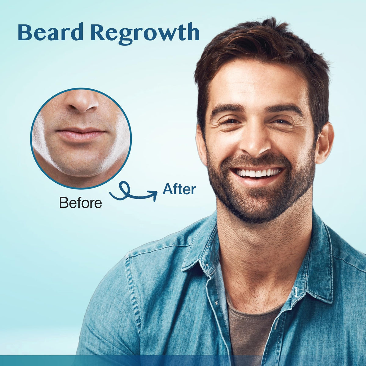 Stafenit applied to thinning scalp area demonstrating direct targeted delivery