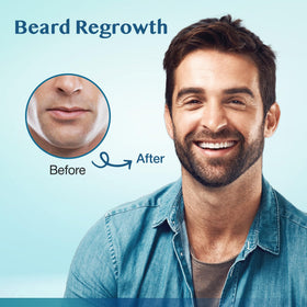 Stafenit applied to thinning scalp area demonstrating direct targeted delivery