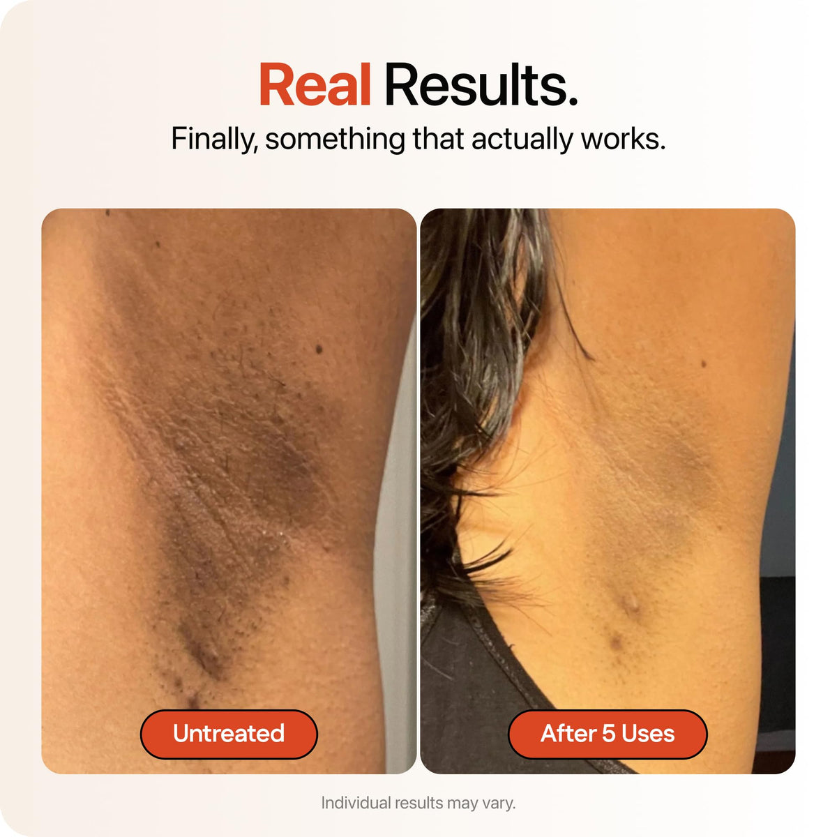Strawberry cream being applied to underarm for targeted discoloration care