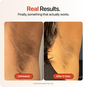Strawberry cream being applied to underarm for targeted discoloration care