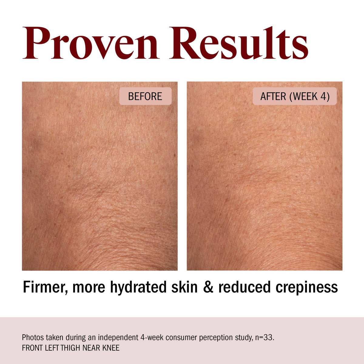 STRIPES applying butter to arm demonstrating absorption and improved smoothness after use
