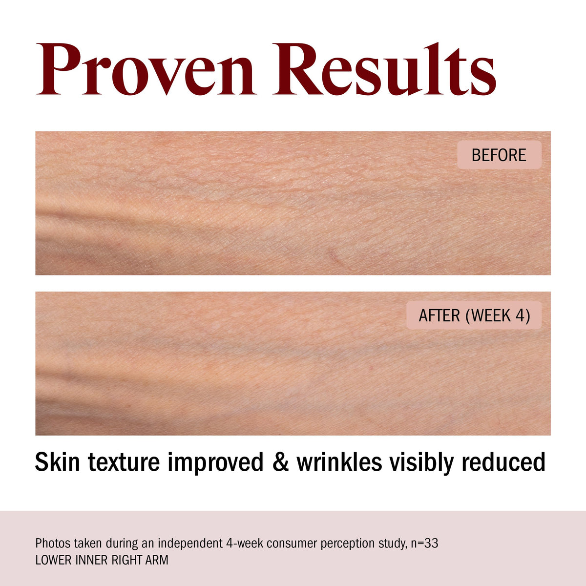 STRIPES ingredient focus ectoine and squalane visual conveying hydration and resilience benefits