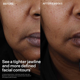 StriVectin 30 mL bottle in hand showing compact travel‑friendly benefit