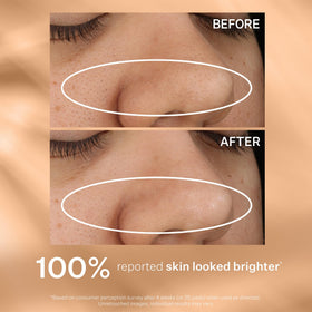 StriVectin pad being applied to cheek demonstrating resurfacing routine